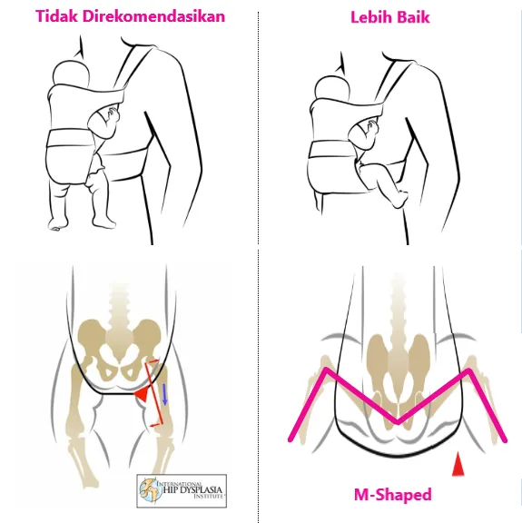 Cara Gendong M Shape Memakai Gendongan Menurut Dokter