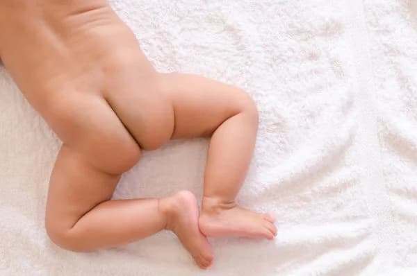 cara mengobati lecet pada dubur bayi