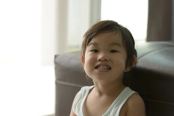 gigi berlubang pada anak 3 tahun