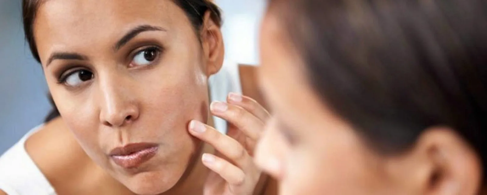 apa itu melasma