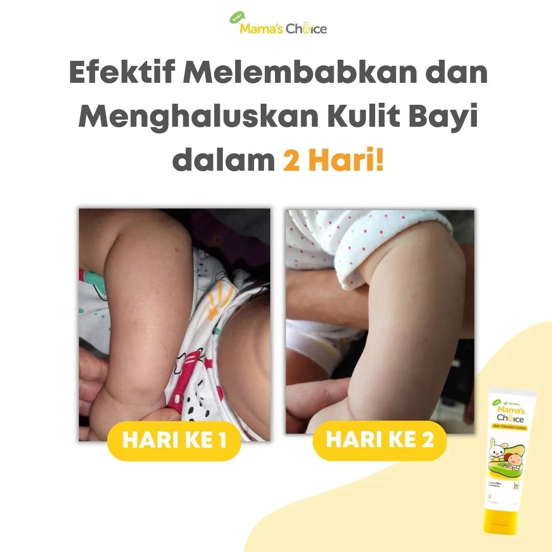 melembapkan dan menghaluskan kulit bayi