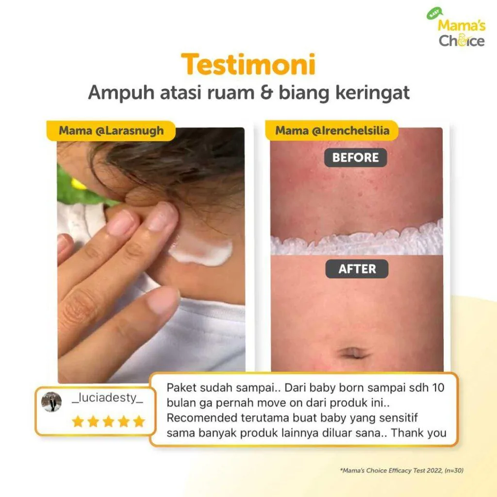 Teruji Efektif, Ini Salep Ruam Popok Bayi Pilihan Mama Indonesia